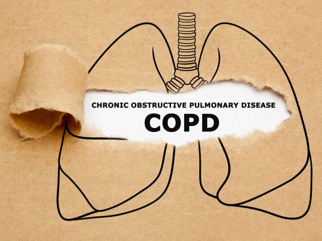 How Do I Know If I Have COPD?