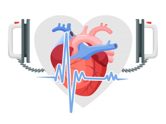 animated heart with defibrillator paddles