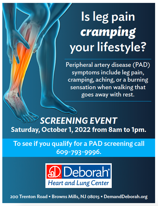 Is leg pain cramping your lifestyle?