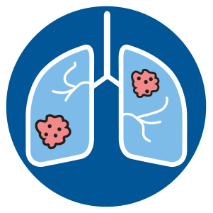 Lung Cancer